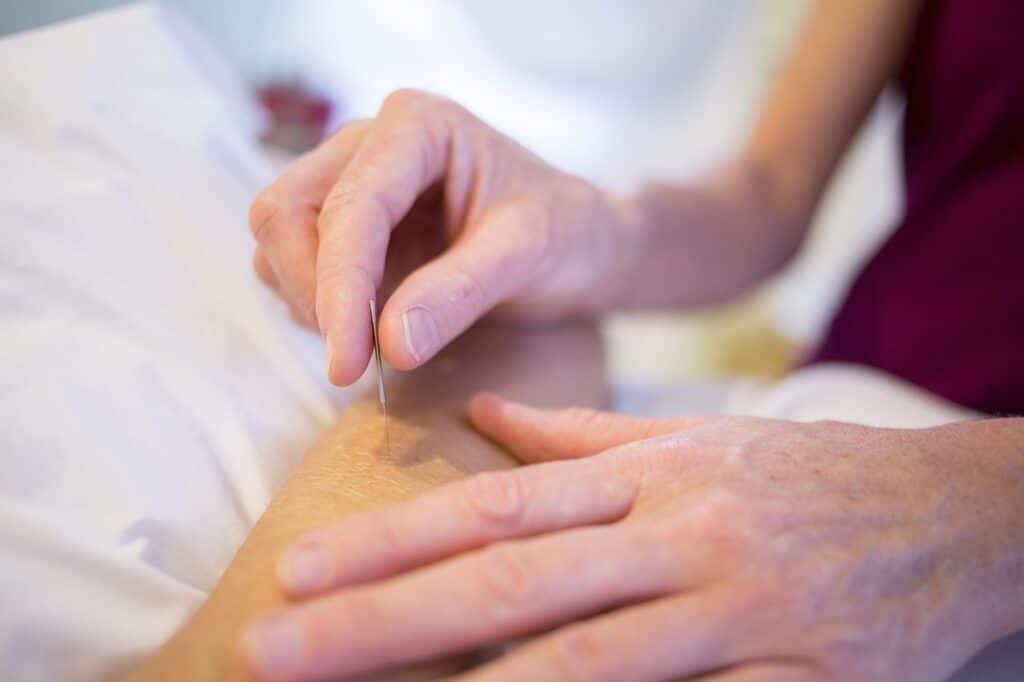 Acupuncture générale